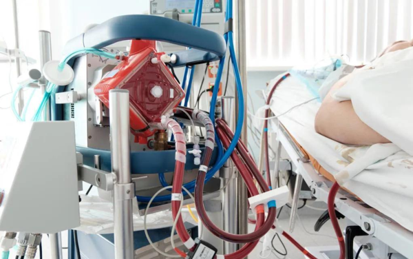 熱點(diǎn) | 填補(bǔ)國(guó)產(chǎn)空白，ECMO迎來(lái)&ldquo;中國(guó)造&rdquo;